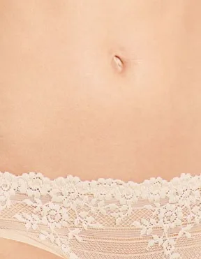 Embrace Lace™ Bikini | 3 Colors Available